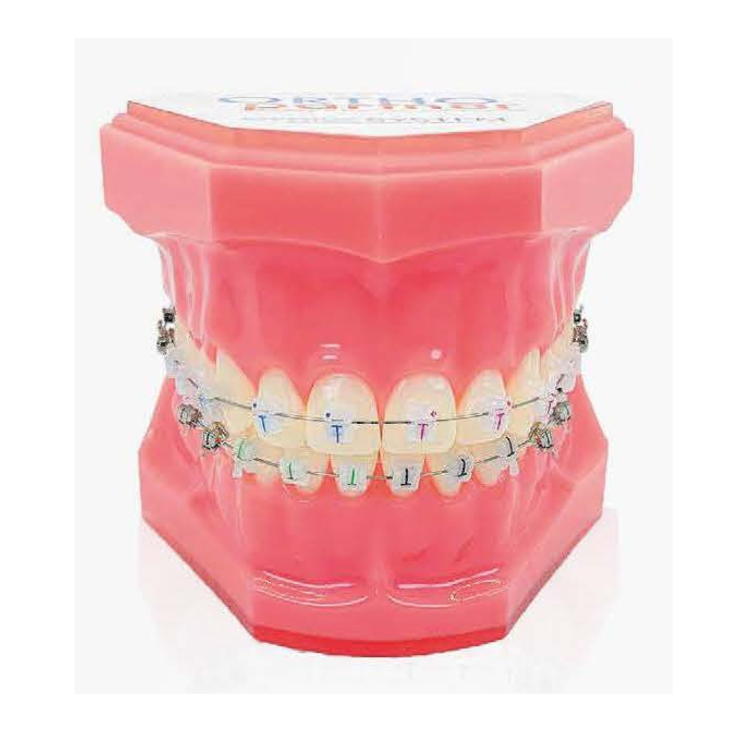 Brackets autoligaturants GENIUS CRYSTAL U 3-3 L 3-3 Hks 3 – Image 7