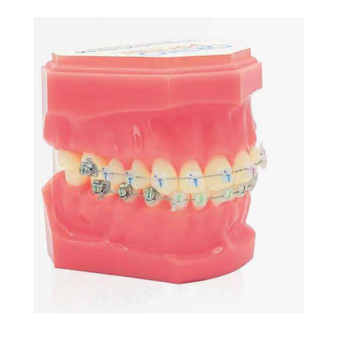 Brackets autoligaturants GENIUS CRYSTAL U 3-3 L 3-3 Hks 3 – Image 9