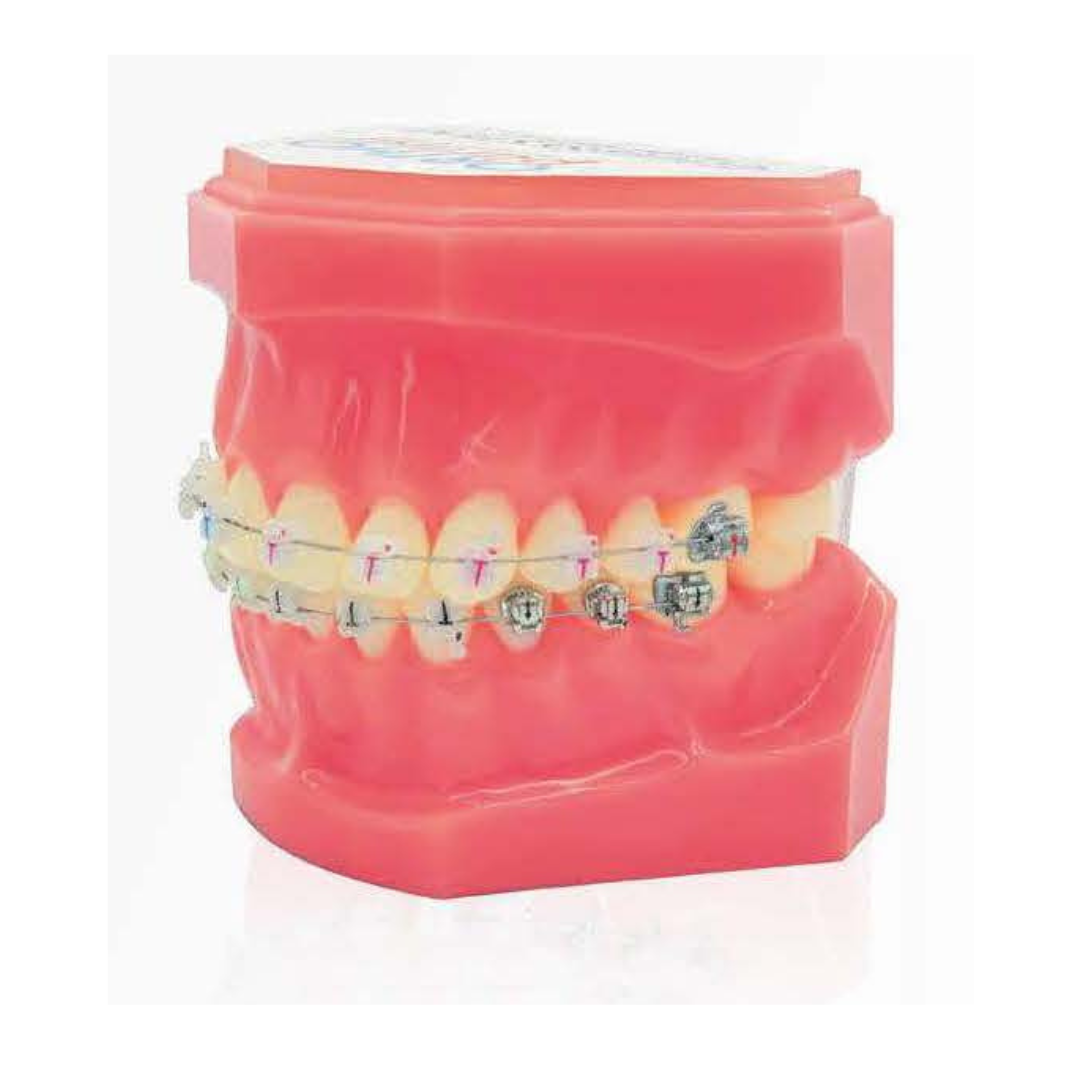 Brackets autoligaturants GENIUS CRYSTAL U 3-3 L 3-3 Hks 3 – Image 10